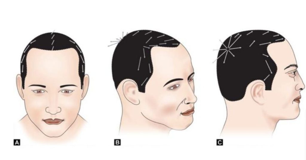 Understanding the Modern Male Scalp and Hair Challenges