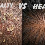 How to Improve Hair Health for Men: A Real-World Restoration Guide